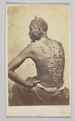 Gordon orvosi vizsgálat alatt, 1863.