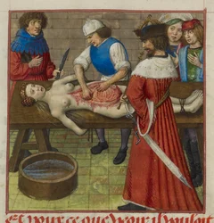 Harley 4425 f.59 Nero nézi, ahogy anyját, Agrippinát boncolják, illusztráció a „Roman de la Rose” című művéből, Jean de Meun és Guillaume de Lorris 1490-1500 körül (vellum)