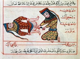 Orvostudomány: egy hermafrodita műtéte. Miniatúra Sharaf al-din török orvoslásról szóló értekezéséből