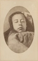 A hisztéria támadása, második fázis, illusztráció a Bourneville et P. Regnard „Iconographie Photographique de La Salpetriere” című művéből, III. tábla, Párizs, 1876 (albumnyomat)