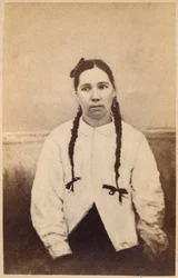 Hisztérikus epilepszia, roham kezdete, illusztráció az „Iconographie Photographique de La Salpetriere” XV. táblájáról, Bourneville et P. Regnard, Párizs, 1876 (albumnyomat)