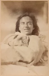 Hisztérikus epilepszia, hallucinációk, irónia, XXXII. tábla Bourneville és P. Regnard „Iconographie Photographique de La Salpêtrière“ című művéből, Párizs, 1876