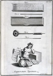 Alternatív gyógyászat: akupunktúrás tűket és alkalmazásukat ábrázoló tábla, metszet Engelbert Kaempfer (1651-1716) „Japán történetéből” (1727) (Akupunktúrás tűk és alkalmazásuk, c 1690 Metszet: G van der Gucht ábra