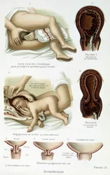 Szülés - tudományos testület, 19. század vége