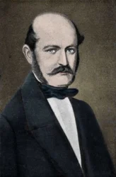 Semmelweis (Semmelweiss) Ignác Fülöp, magyar szülész (1818-1865) portréja.