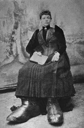 A Szörnyek, Bertha nagy lábbal. Fényképészet, 19. század vége, Párizs. Coll. Selva.