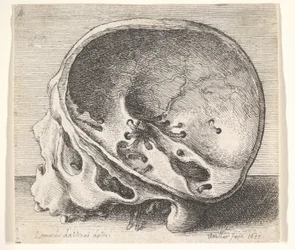 Balra metszett koponya, a koponya bal oldalával eltávolítva, 1651.