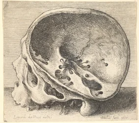 Balra metszett koponya, a koponya bal oldalával eltávolítva, 1651.