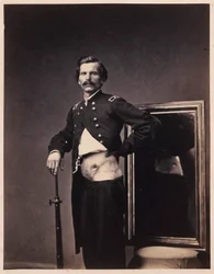 H. A. Barnum őrnagy, felépülés egy hasi lőtt seb után, a bal Ilium perforációjával, a sebészeti részleg fényképkatalógusából